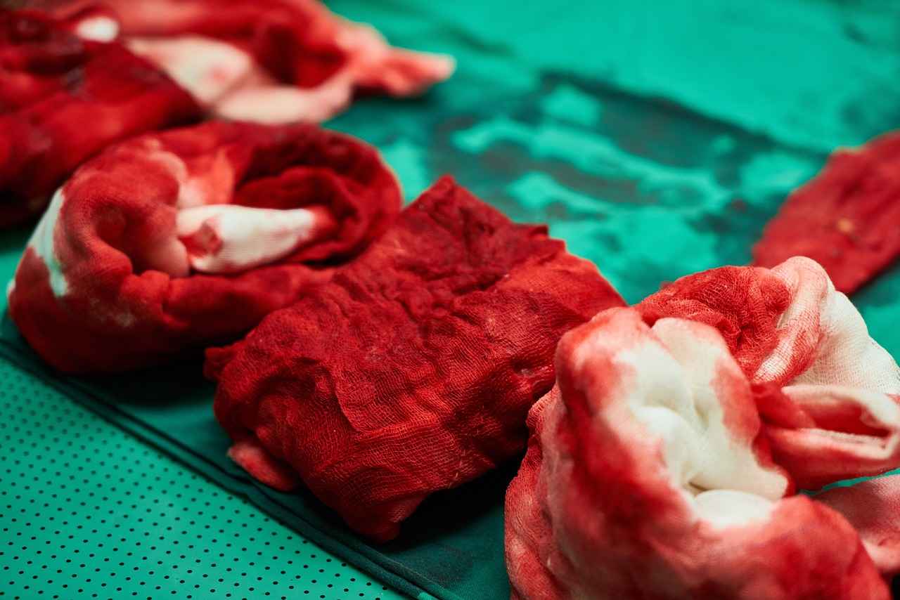 Factors Influencing Vascular Surgery Costs