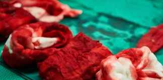 Vascular Surgery Clinics & Hospitals Near Me: How to Find the Most Professional Services Vascular Surgery Clinics & Hospitals Near Me: How to Find the Most Professional Services