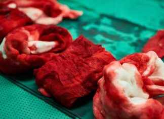 Vascular Surgery Clinics & Hospitals Near Me: How to Find the Most Professional Services Vascular Surgery Clinics & Hospitals Near Me: How to Find the Most Professional Services